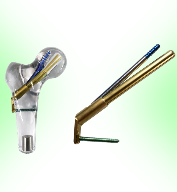 Femoral Neck System Implant